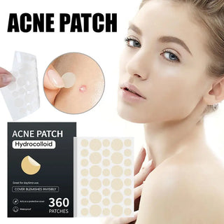 360PCS Eelhoe Acne Blemish Patch Sticker Waterproof Acne Treatment