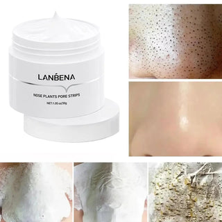 LANBENA Blackhead Remover