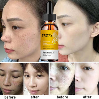 Vitamin C Serum Face Glowing Dark Spot Remover Skincare Moisturizer Wrinkle Remove Anti Aging Facial Serum Korean Cosmetics