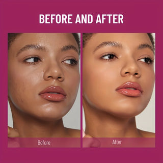 USHAS Sponge Head Concealer, Long-Lasting Cream Concealer for Dark Circles, Freckles, Acne Marks, Pigmentation, Blemishes, and Whole-Face Coverage
