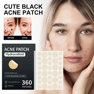 360PCS Eelhoe Acne Blemish Patch Sticker Waterproof Acne Treatment